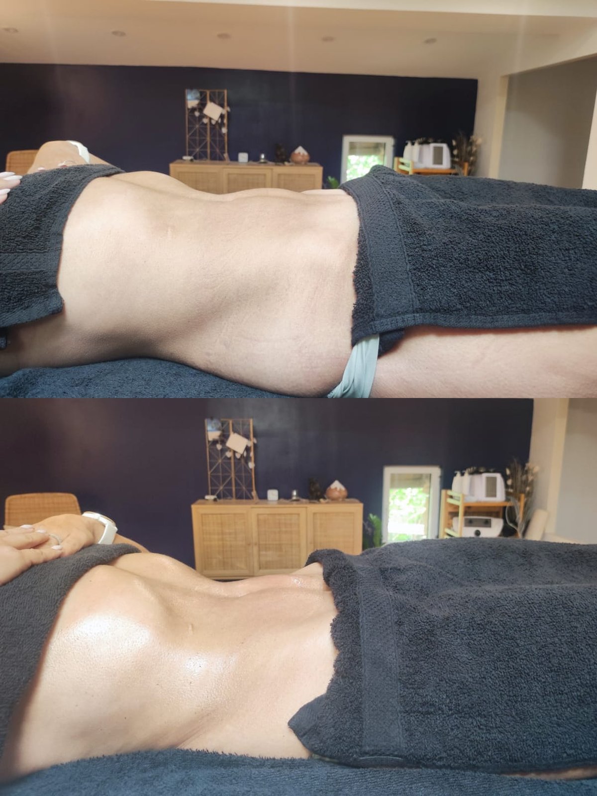 Bienfaits du drainage lymphatique